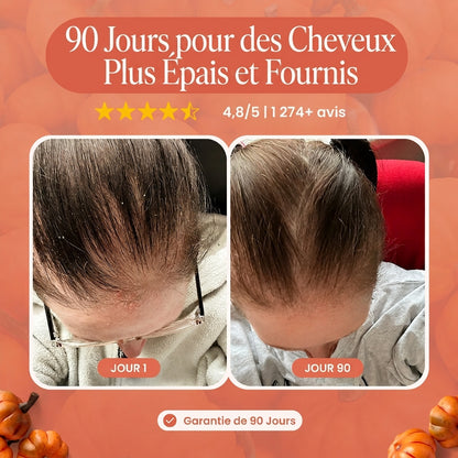 Huile de Pépins de Courge – Anti-Chute & Croissance des Cheveux