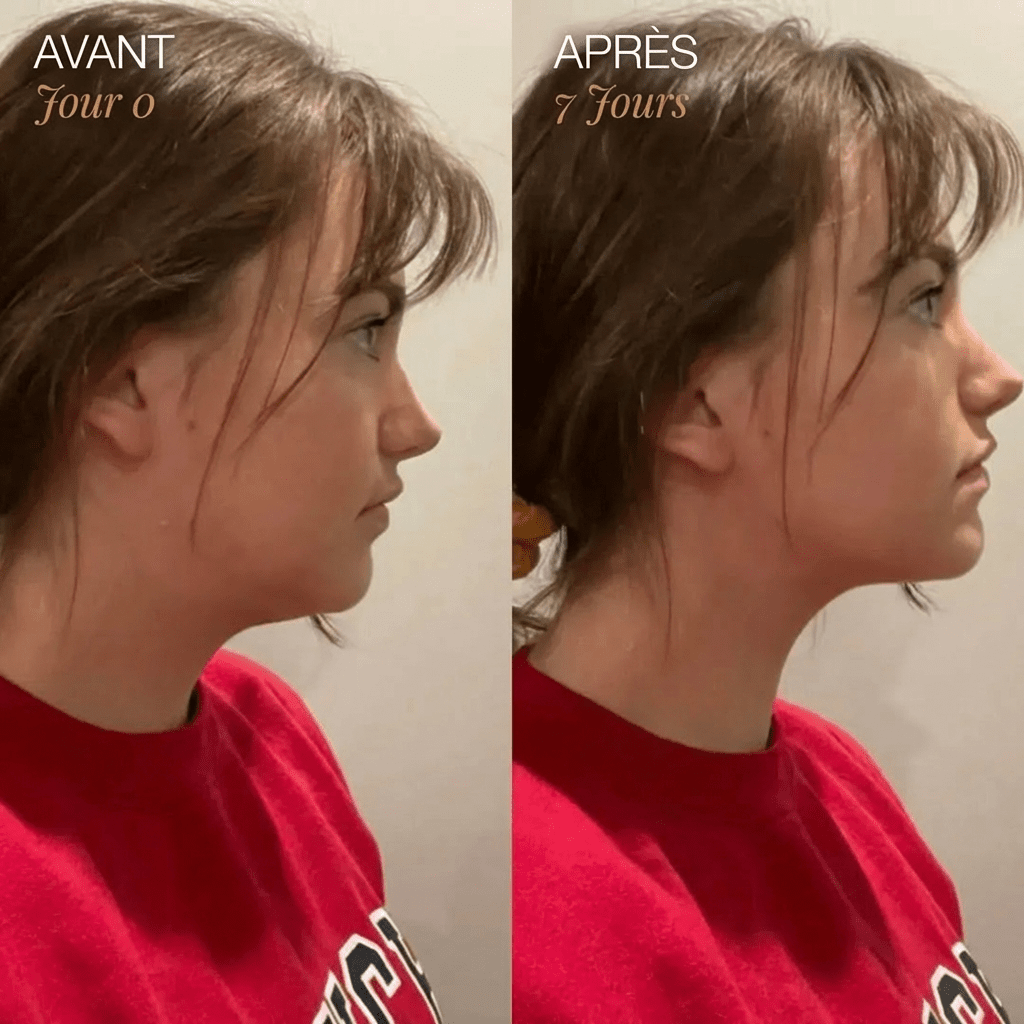 Brosse de Drainage Lymphatique pour Visage - Blooe™