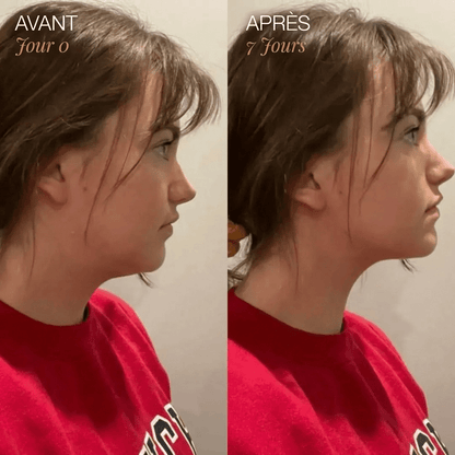 Brosse de Drainage Lymphatique pour Visage - Blooe™