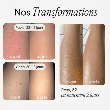 Brosse pour le corps - Blooe™