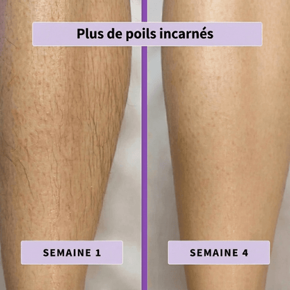 Sérum Anti-Repousse Blooe
