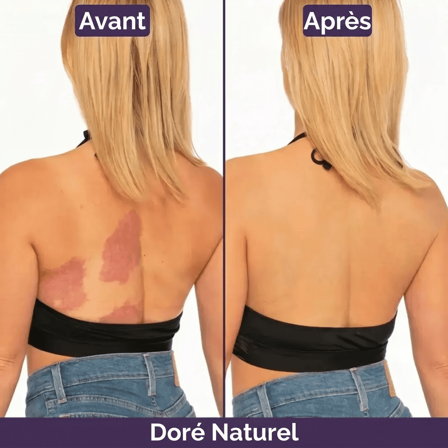 Blooe™ - Un corps sans imperfections