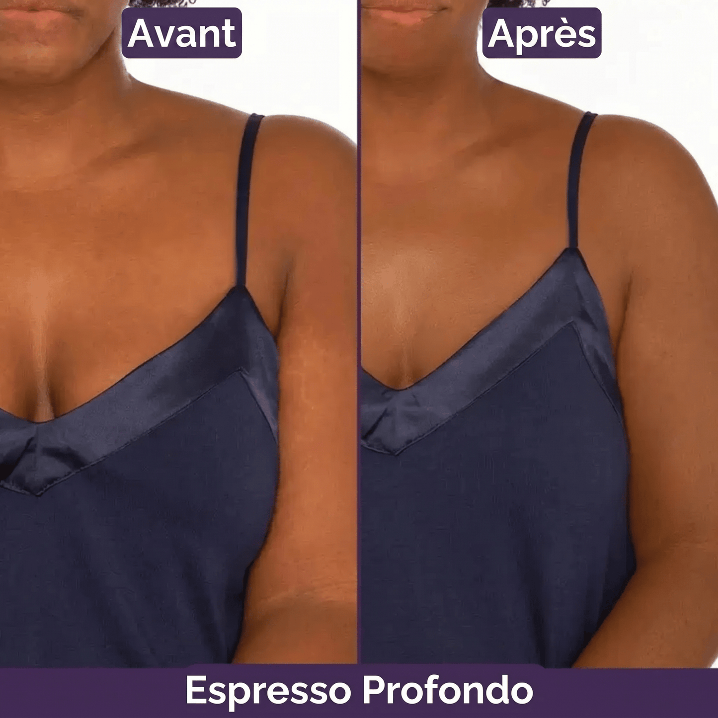Blooe™ - Un corps sans imperfections