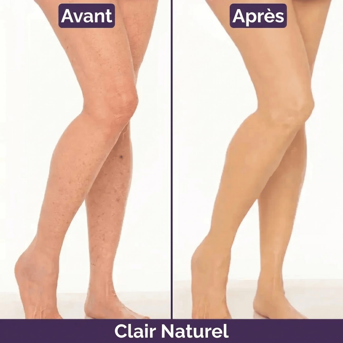 Blooe™ - Un corps sans imperfections