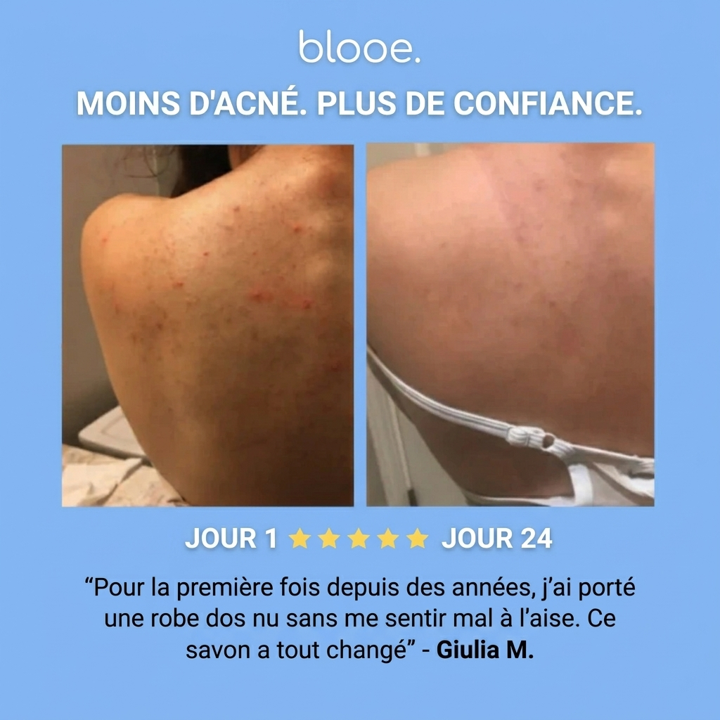 Savon Purifiant Anti-Acné - Blooe™