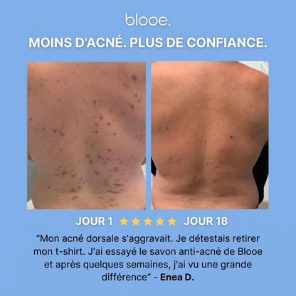 Savon Purifiant Anti-Acné - Blooe™