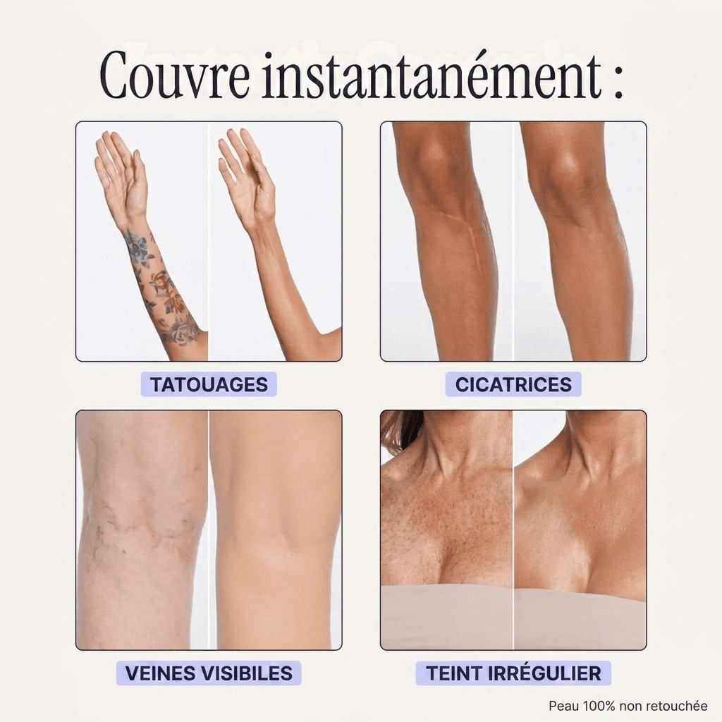 Blooe™ - Un corps sans imperfections