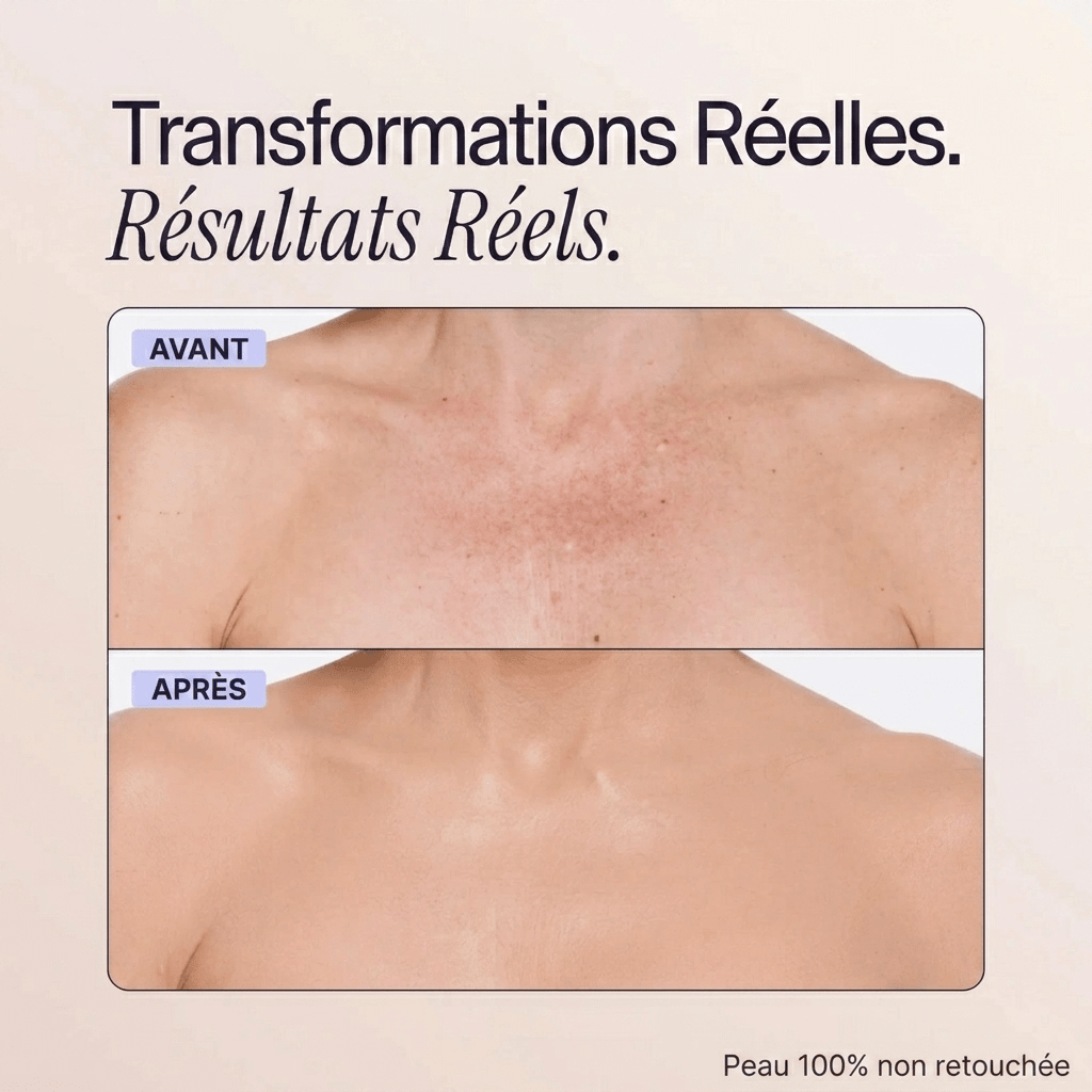 Blooe™ - Un corps sans imperfections
