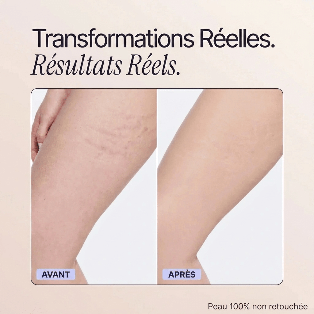 Blooe™ - Un corps sans imperfections