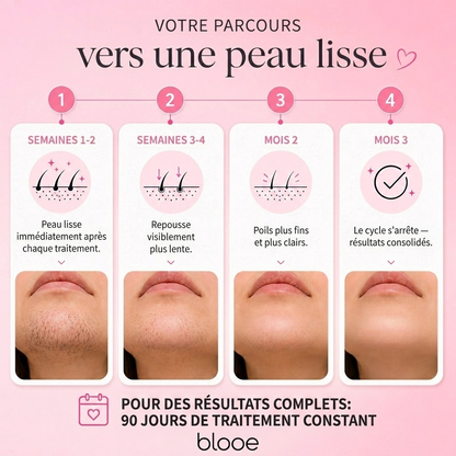 Le premier kit complet en 3 étapes qui affaiblit et dissout les poils hormonaux sans douleur ni irritation.