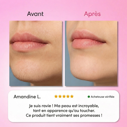 Le premier kit complet en 3 étapes qui affaiblit et dissout les poils hormonaux sans douleur ni irritation.