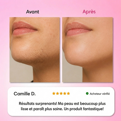 Le premier kit complet en 3 étapes qui affaiblit et dissout les poils hormonaux sans douleur ni irritation.