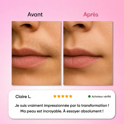 Le premier kit complet en 3 étapes qui affaiblit et dissout les poils hormonaux sans douleur ni irritation.